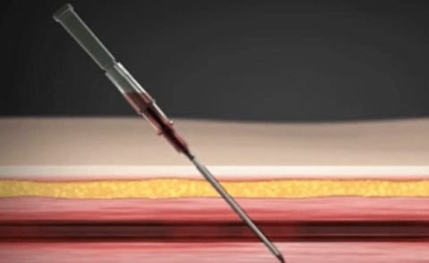 TRACK NEEDLE (Introducer Puncture Needle) - Image 8